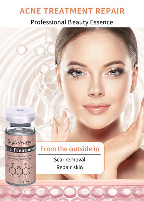 OEM ODM Stalidearm Serum Anti jerawat Perawatan Herbal Perawatan Perbaikan Kulit Solusi Perawatan Anti jerawat jerawat bekas luka Penghilang Wajah Serum
