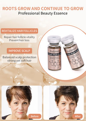Perawatan Anti Rambut Kualitas Terbaik Perawatan Kulit Kepala Mencegah Rambut Rambut Serum Pertumbuhan