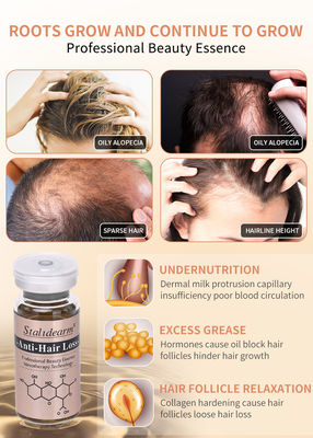 Serum Anti Rontok Rambut Set Tidak Ada Jarum Mesoterapi Rumus Untuk Pertumbuhan Rambut 10ml/Botol Label Pribadi