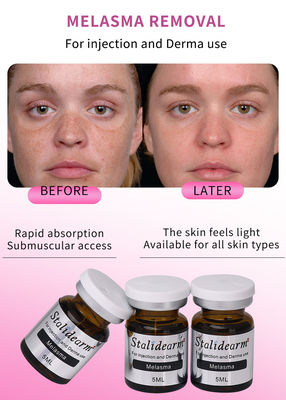 5ml Anti Melasma Serum Injeksi Cairan Set Dengan OEM kustomisasi