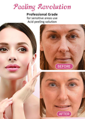 30ml Skin Peeling Serum / Professional Grade Liquid Set untuk Solusi Pengelupasan Kulit Wajah