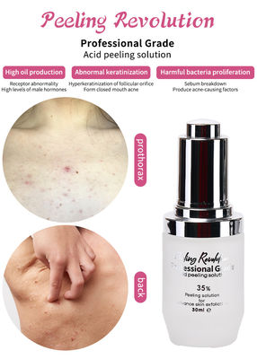 Serum Pengelupasan Kulit Berkualitas Profesional Set Produk Perawatan Kulit Pembersihan Perbaikan Kulit Revitalisasi Solusi Pengelupasan