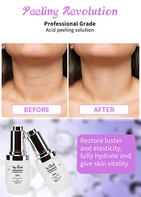 Serum Pengelupasan Wajah Berkualitas Profesional Set untuk Solusi Pengelupasan Kulit