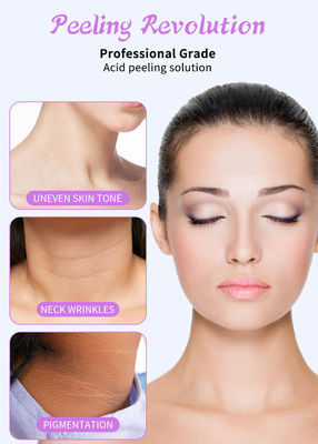 Serum Pengelupasan Wajah Berkualitas Profesional Set untuk Solusi Pengelupasan Kulit