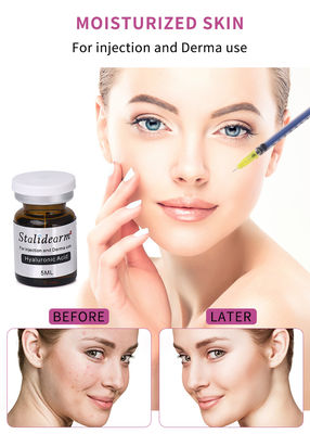 Stalidearm Hyaluronic Acid Serum Wajah Injeksi Untuk Ultimate Skin Boosting & Mesotherapy