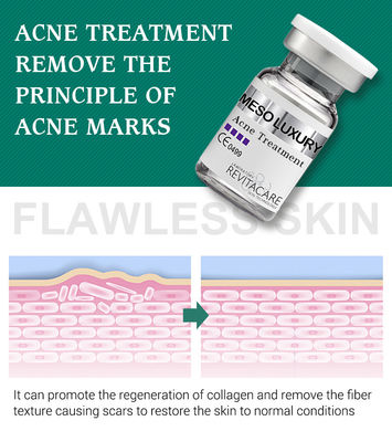 Pure Plant Pimple Clear Serum Whitening Treatment Mesotherapy Untuk Bekas Jerawat