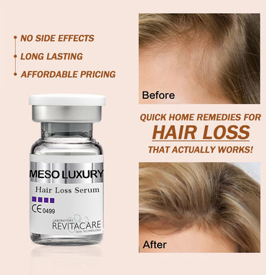 Perawatan Serum Pertumbuhan Kembali Rambut Herbal Alami 10ml Label Pribadi Kustom