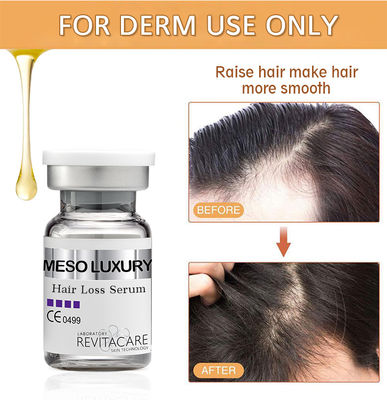 Perawatan Serum Pertumbuhan Kembali Rambut Herbal Alami 10ml Label Pribadi Kustom