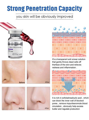 LUXURY Meso Serum Microneedling Esensi Pemutih Kulit Langsung Menyerap 10ML