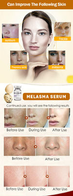 Perawatan Kulit Meso Serum Microneedling Removal Serum Bintik Melasma Pemutih Kulit