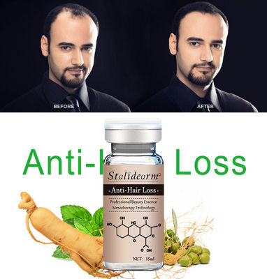 10ml Serum Anti Rambut Rontok Bahan Tanaman Serum Pertumbuhan Rambut Alami Microneedling