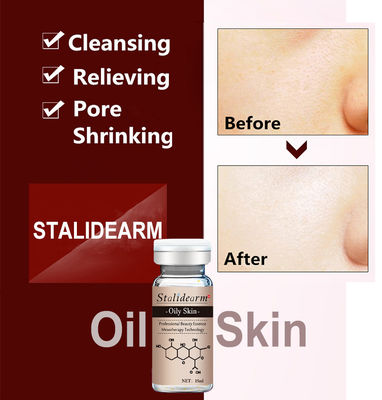 Serum Herbal Organik Anti Jerawat Label Disesuaikan Dermapen Esensi Wajah Untuk Kulit Berminyak
