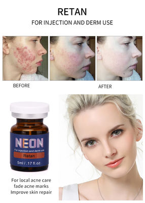 Neon Meso Therapy Serum Injeksi 5ml Serum Perawatan Jerawat Pure Essence
