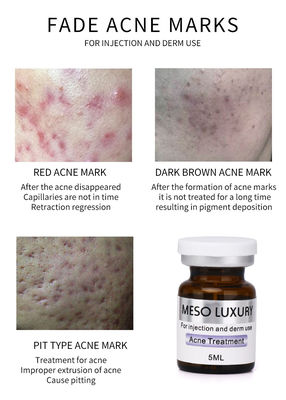 Luxury Youth Serum Injection Mesotherapy Bintik Merah Perawatan Injeksi Jerawat Kulit