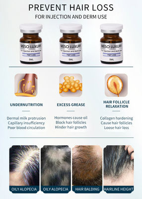 Perawatan Injeksi Mesotherapy Serum Anti Rambut Rontok Mewah Untuk Pertumbuhan Rambut