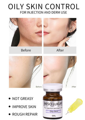 Kontrol Minyak Serum Keseimbangan Kulit Meso Luxury 24k Gold Peptide Serum Set Private Label OEM