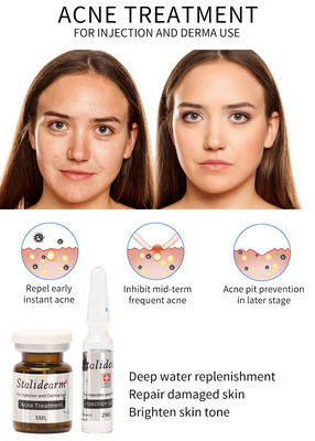 Exosome Skin Booster France Original Stalidearm Perawatan Jerawat Injeksi Serum Solusi Mesoterapi