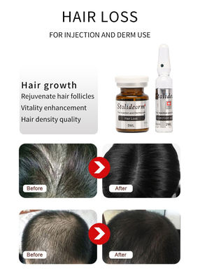 Serum Eksosom Rambut Injeksi Perancis Solusi Mesoterapi Pertumbuhan Rambut Asli Stalidearm