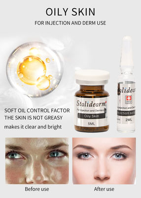 Oily Youth Serum Injeksi ‏Oil Control Mesotherapy Perawatan Kulit