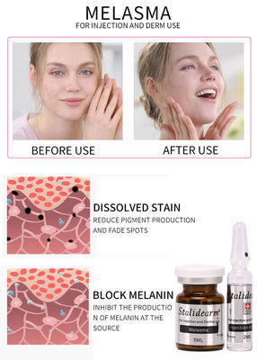 Injeksi Melasma Gunakan Serum Aman Dan Efek Baik Mesotherapy 5ml/botol serum set