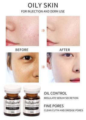 Serum Injeksi Untuk Kulit Berminyak 5ml/Botol Aman Efek Baik Essence Set Original Stalidearm Brand