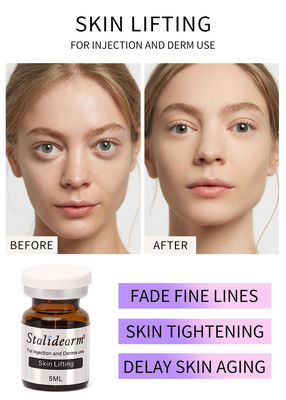 Stalideram Anti Aging Skin Lifting Serum Injeksi Kepala Injeksi Perawatan Kulit PRP efek bagus alami